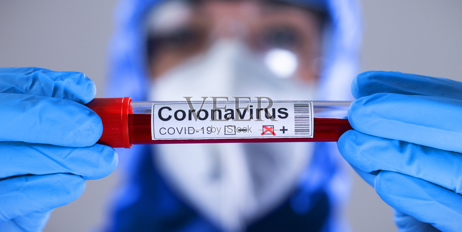 冠状病毒COVID - 19检测新型冠状病毒暴发照片摄影图片