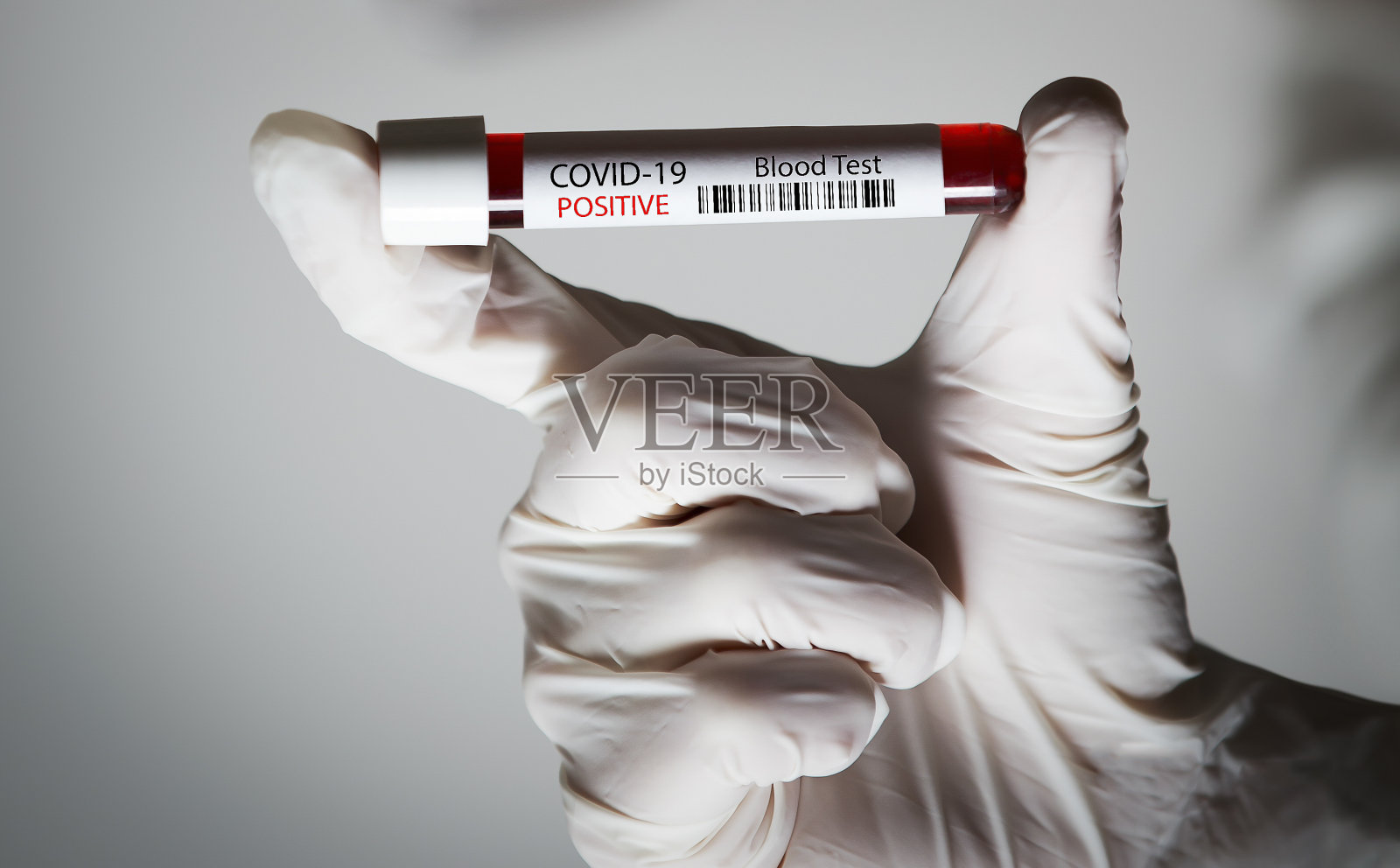 冠状病毒检测样本的详细资料照片摄影图片