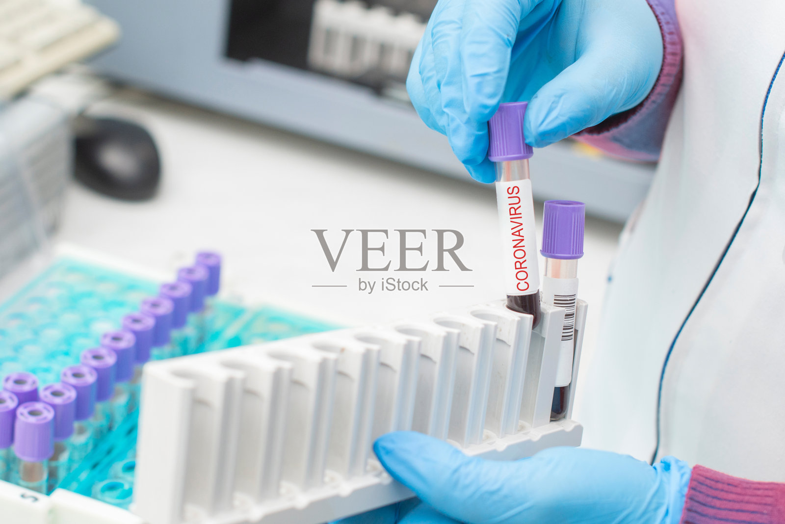 在实验室背景的分析机器架上，医生手拿血样管/在研究实验室拿着冠状病毒阳性血样管的技术员照片摄影图片