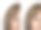 脸部妇女皱纹的前后程序素材图片